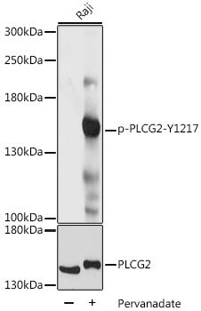 PLCG2 (Phospho-Y1217) antibody