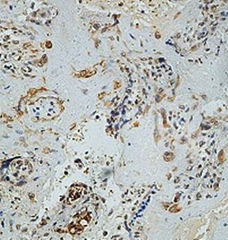 PLCXD1 Rabbit Polyclonal Antibody