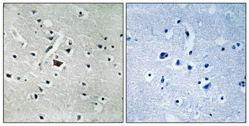 PLD2 (Phospho-Tyr169) Antibody