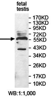 PLD3 Rabbit Polyclonal Antibody