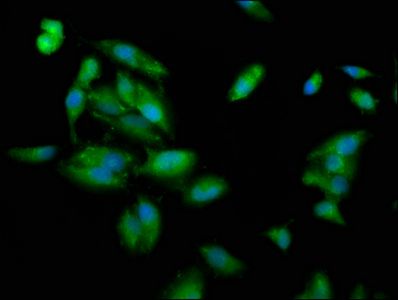 PLEC Antibody