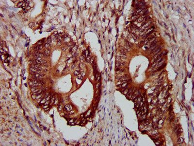 PLEC Antibody