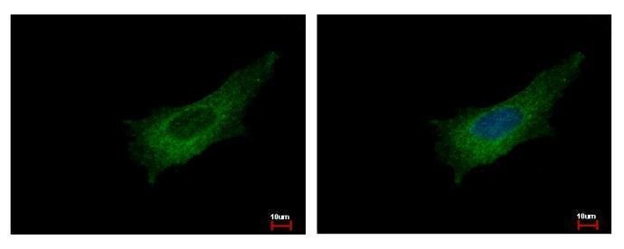 Pleckstrin Rabbit Polyclonal Antibody