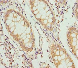 PLEKHA1 Antibody