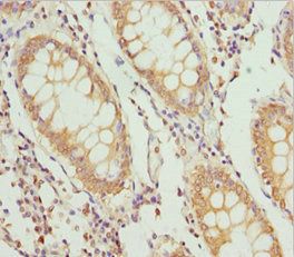 PLEKHA1 antibody