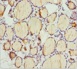 PLEKHA1 Antibody