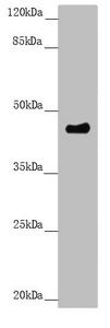 PLEKHA1 Antibody