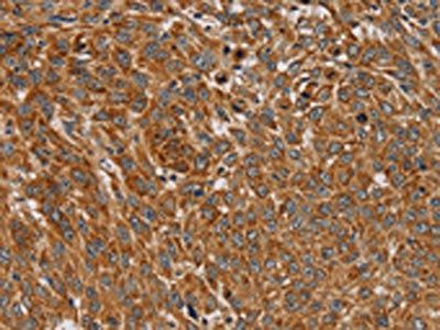 PLEKHG6 Antibody