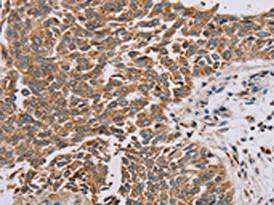 PLEKHG6 Antibody