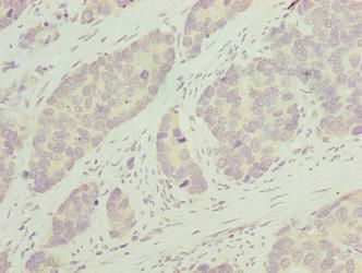 PLEKHJ1 Antibody
