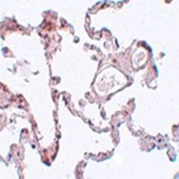 PLEKHM1 Antibody