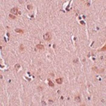 PLEKHM2 Antibody
