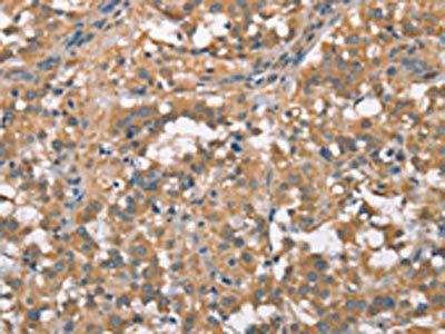 PLEKHO1 Antibody