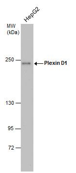 Plexin D1 antibody [C3], C-term