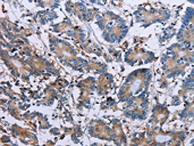 PLG Antibody