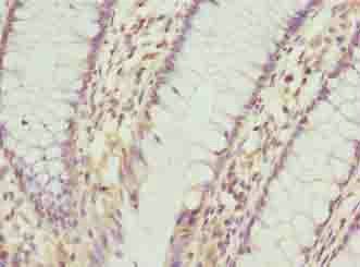 PLGRKT antibody