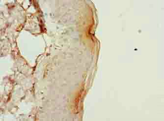 PLGRKT Antibody