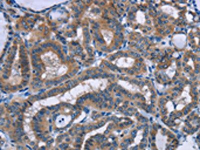 PLIN1 Antibody