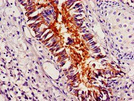 PLIN1 Antibody