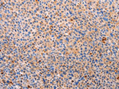 PLIN2 Antibody