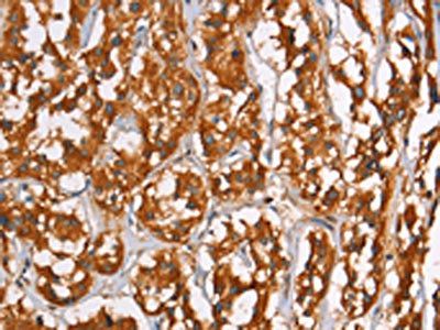 PLIN2 Antibody