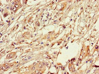 PLIN3 Antibody