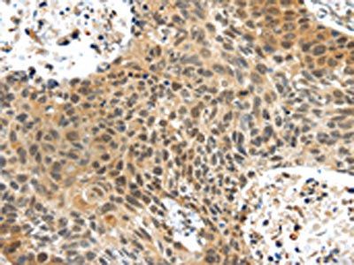 PLIN3 Antibody