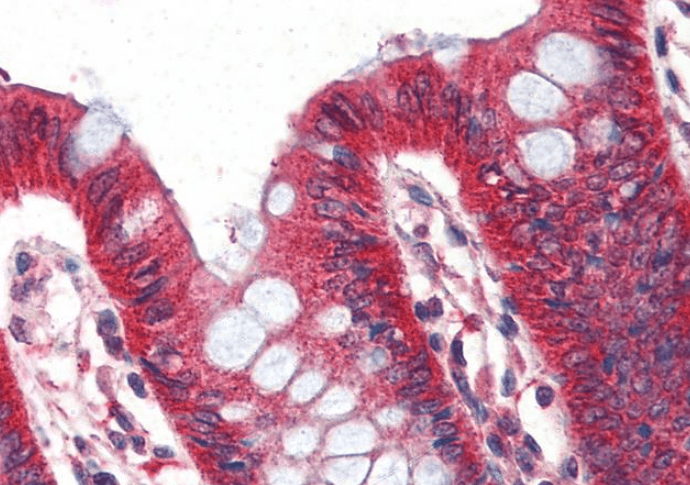 Goat anti-Perilipin 1 (internal) Antibody