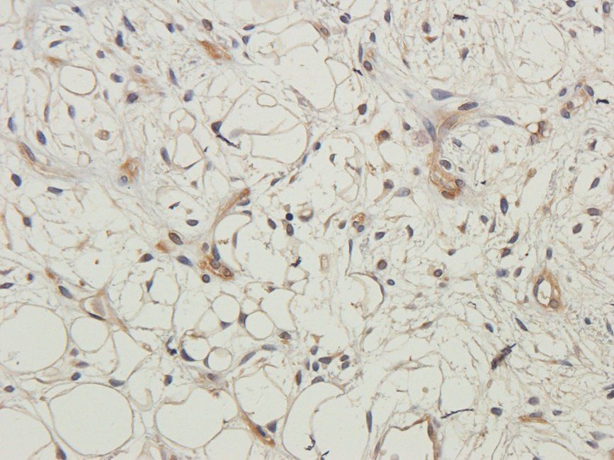 PLK1 antibody