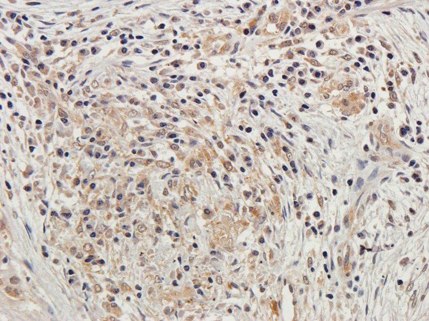 PLK1 antibody