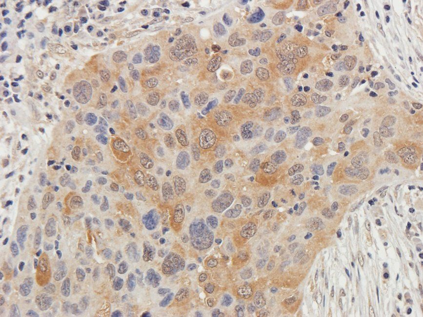 PLK1 antibody