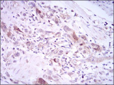 PLK1 Antibody