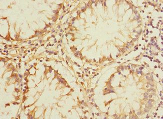 PLK3 Antibody