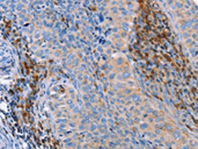 PLK3 Antibody