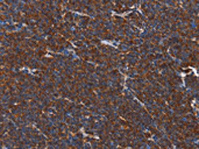 PLK3 Antibody
