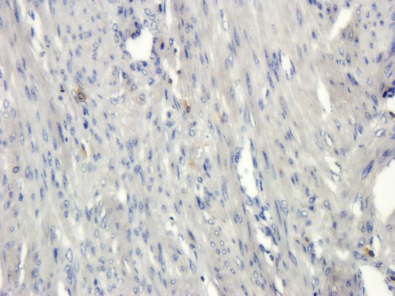 PLK4 antibody