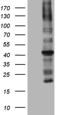 PLOD2 Antibody