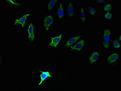 PLPP2 Antibody
