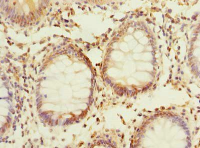 PLPP2 Antibody