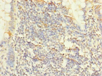 PLPP2 Antibody