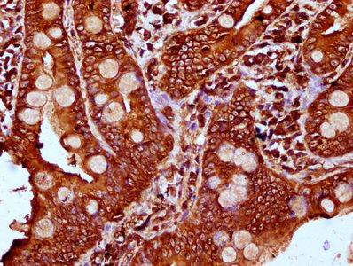 PLS1 Antibody