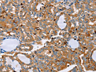 PLS3 Antibody