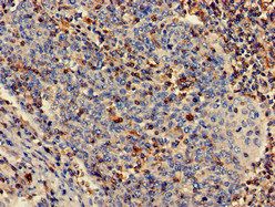 PLS3 Antibody