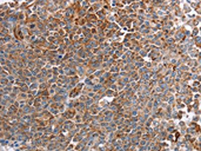 PLXNA2 antibody