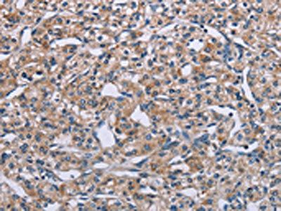 PLXNA2 Antibody