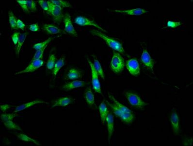 PLXNB1 antibody