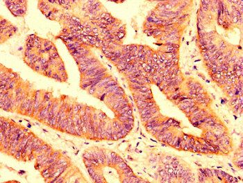 PLXNB1 Antibody