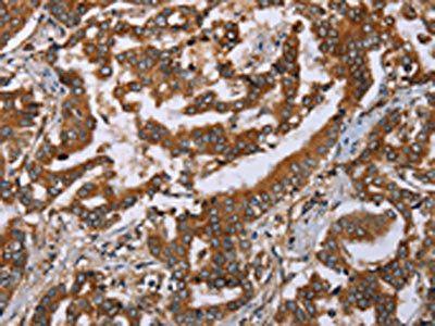 PLXNB1 Antibody
