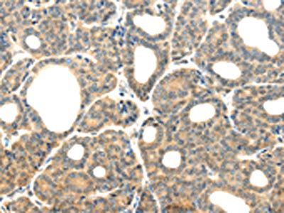 PLXNB2 Antibody