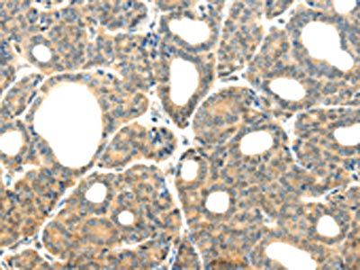 PLXNB2 antibody